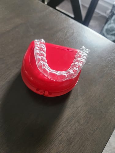 Customer photo review of Upper Teeth Retainer