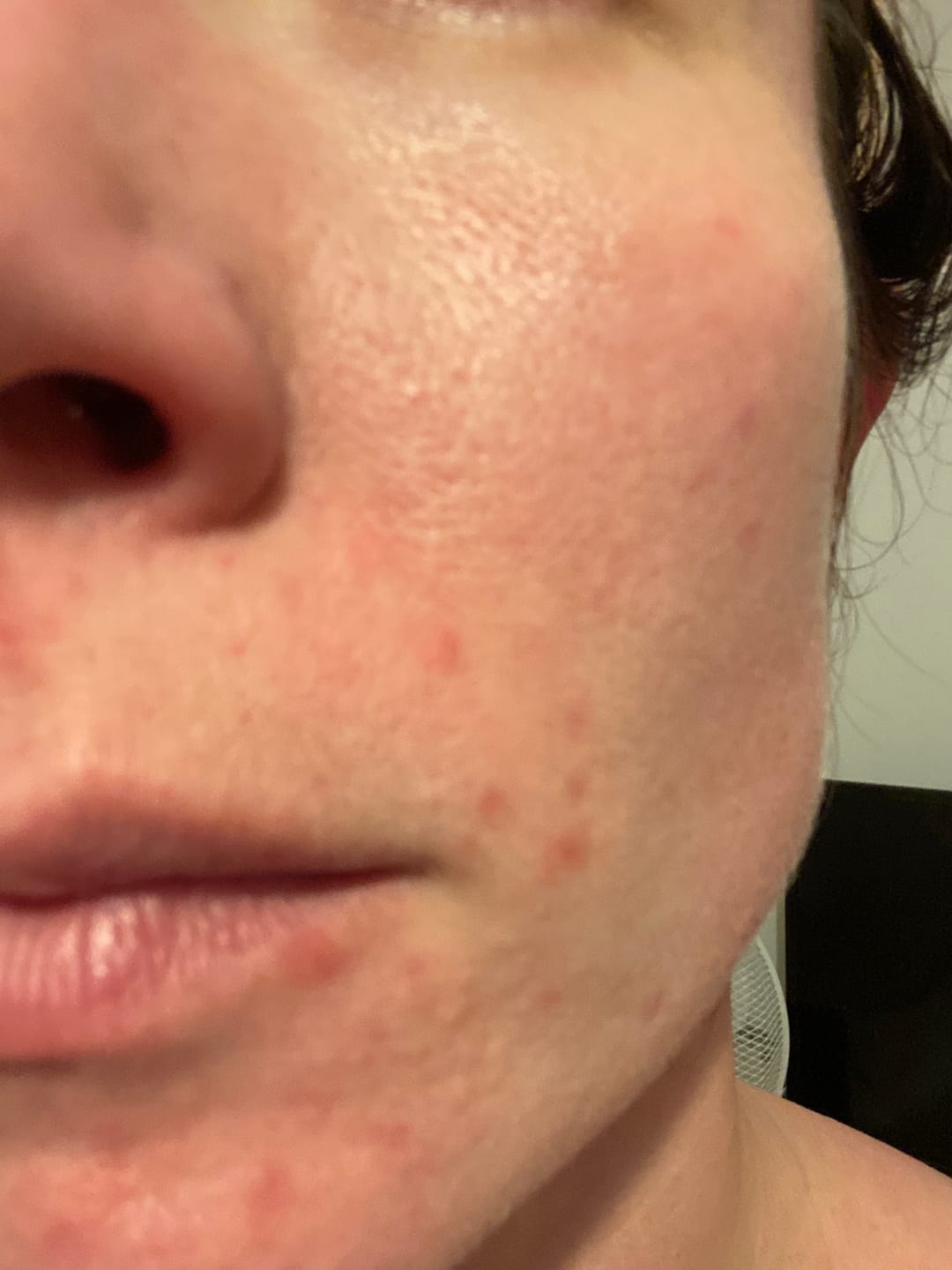 Customer photo review of Spot Soothe