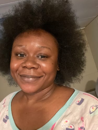 Customer photo review of BERRI-CLEAR+ 5 BERRY SUPERFRUIT SERUM