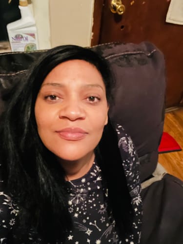 Customer photo review of Berri-Clear Brightening Gel Cleanser