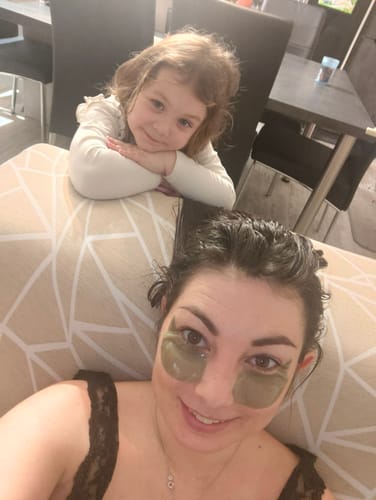 Customer photo review of Patchs Hydratants | Éliminez cernes & rides