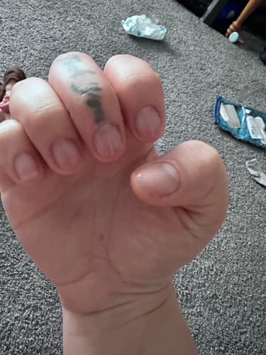 Customer photo review of Rocket Nail Fuel Nail Repair - Clear