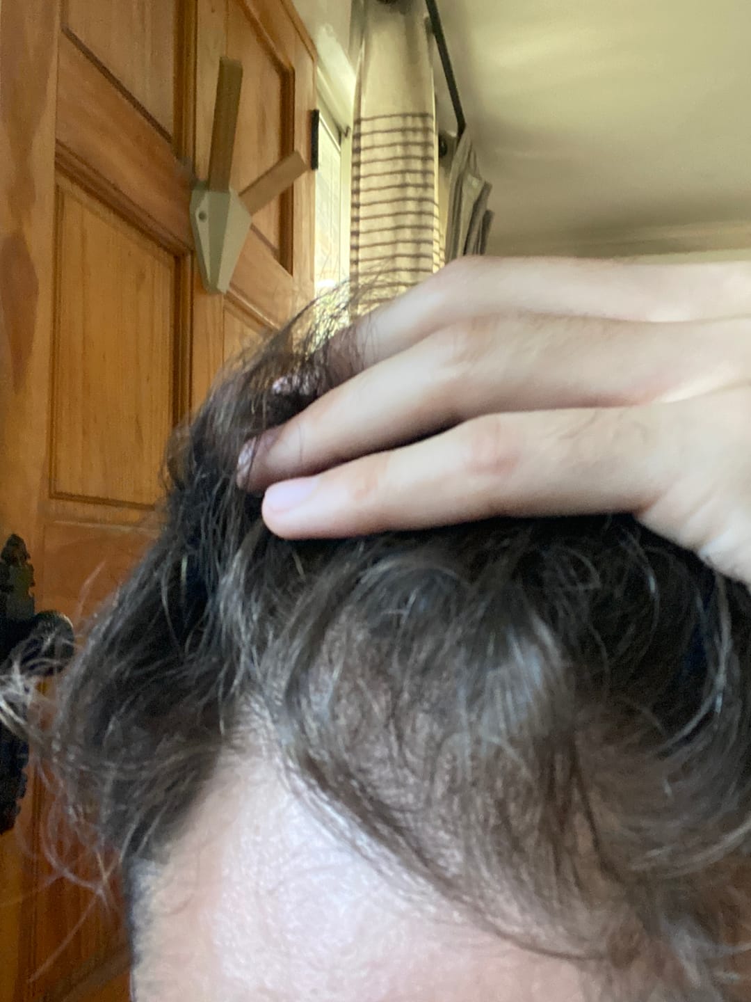 Customer photo review of Shampoo Anticaída