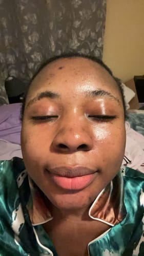 Customer photo review of Neoprosone Brightening Gel 30g