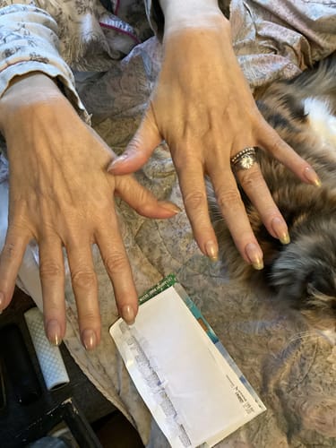 Customer photo review of Rocket Nail Fuel Nail Repair - Clear