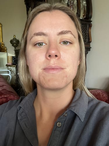 Customer photo review of Skin & Gut Maintain™