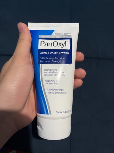 Customer photo review of PanOxyl Maximum Strength Antimicrobial Acne Foaming Wash for Face