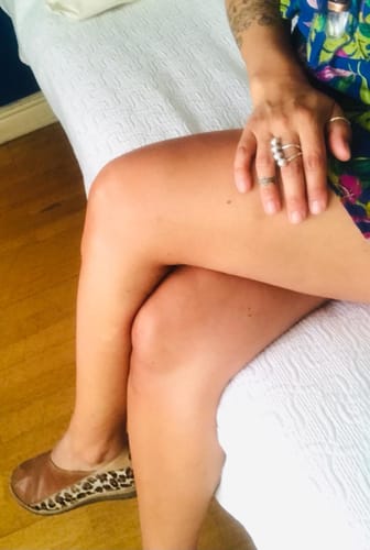 Customer photo review of Depilador Nuva Skin®