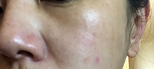 Customer photo review of B-Restore Barrier Cream