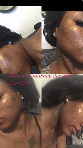 Customer photo review of Berri-Clear Brightening Gel Cleanser