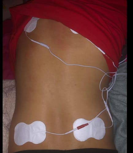 Customer photo review of VigorEight™ Tens Muscle Stimulator Pro