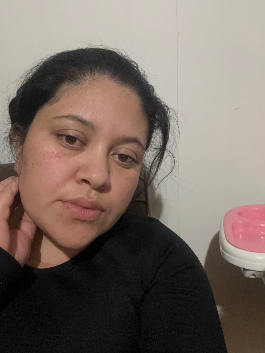 Customer photo review of Amazonia Antarctic Blue Prescription Colored Contact Lenses