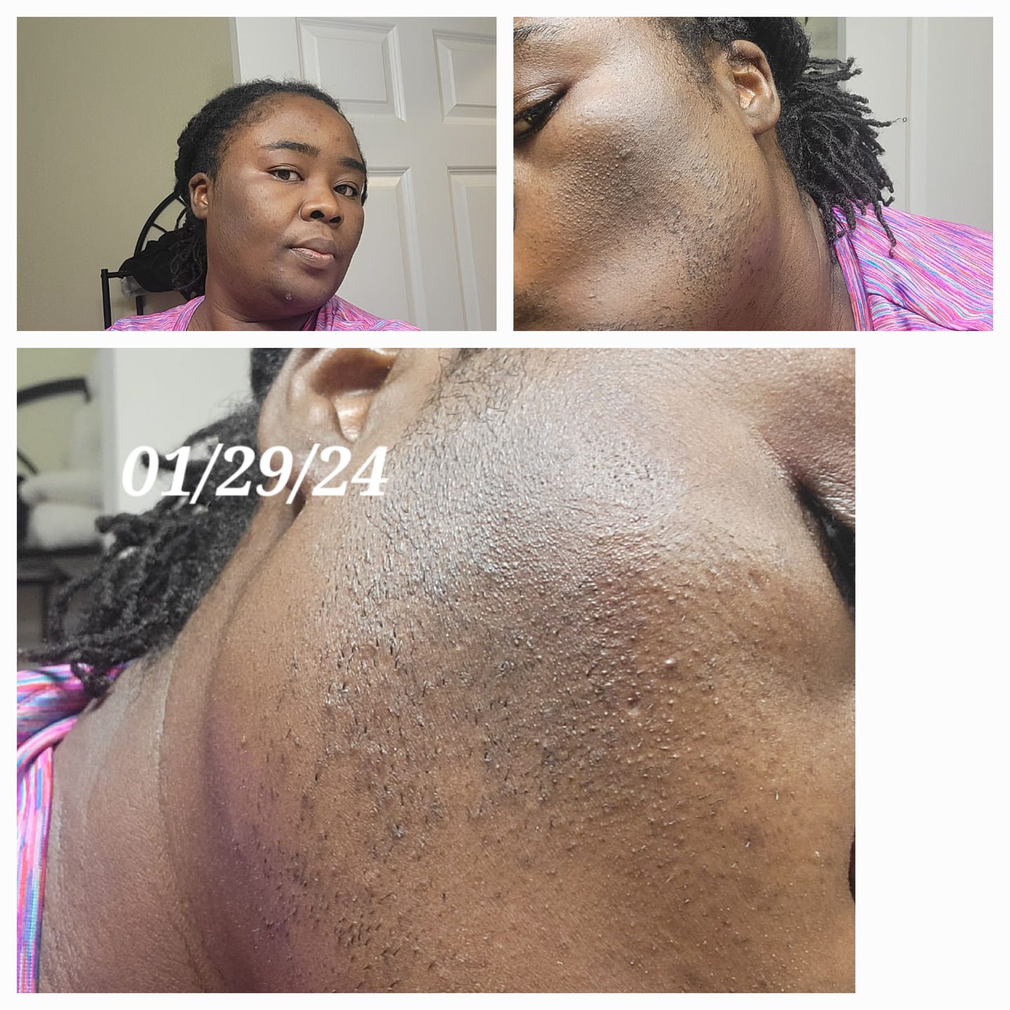 Customer photo review of GLOW COMBO
