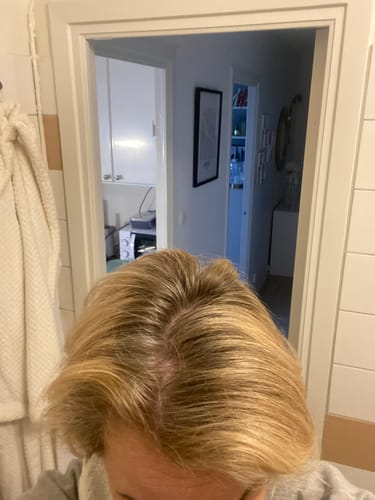 Customer photo review of Sunkissed Starter Kit