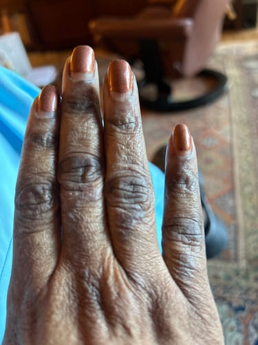 Customer photo review of Miracle Hands & Feet Set