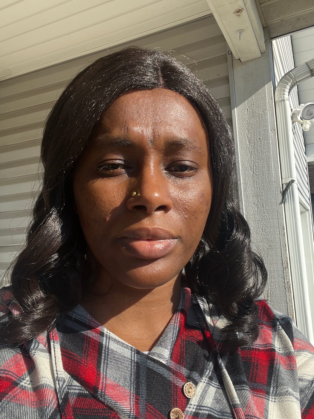 Customer photo review of Turmeric Glow wash for black spots,acne & glow