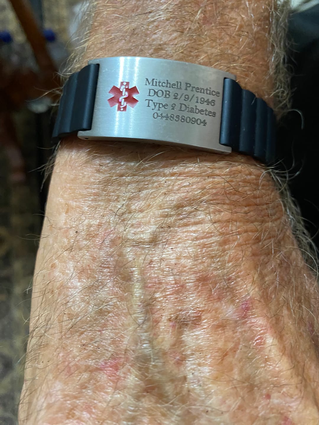 Customer photo review of Magnetic Sports Medical ID Bracelet