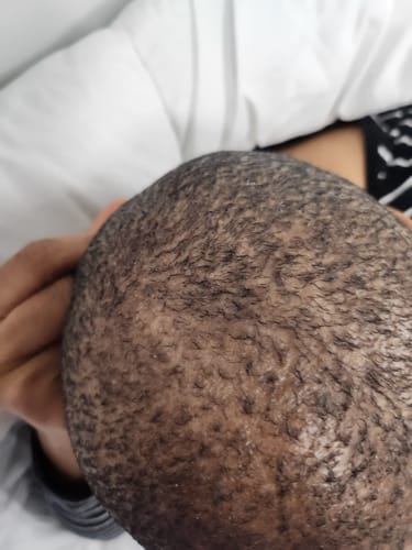 Customer photo review of HAIR GROWTH OIL (rapid growth)  (60ml)