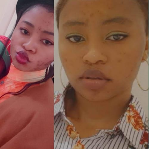 Customer photo review of Dark spots + Glow combo