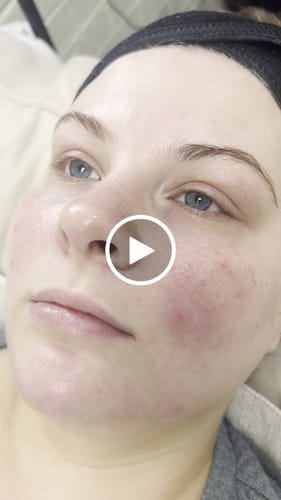 Customer video review of BOO- Professional Lash Kit
