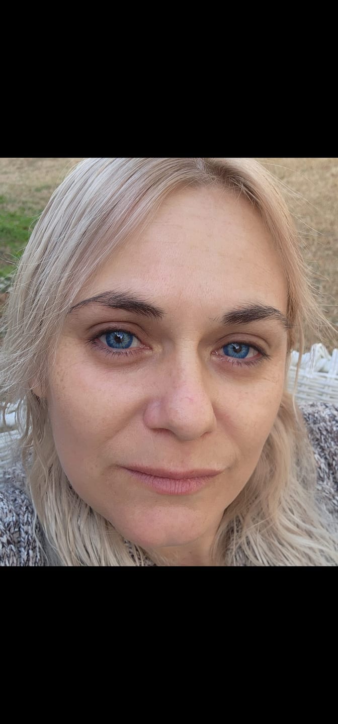 Customer photo review of Amazonia Antarctic Blue Prescription Colored Contact Lenses