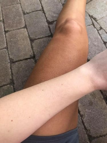 Customer photo review of Desert Bronze Self Tanning Mousse