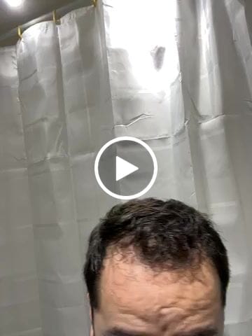 Customer video review of TRÈS[S] GROWN - Hair Growth Serum