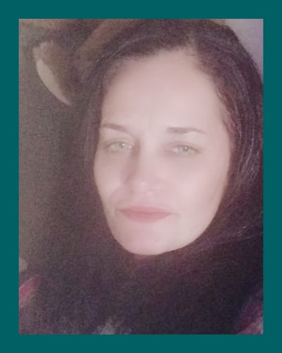 Customer photo review of Green Illusion Contact Lenses(12 months of use)