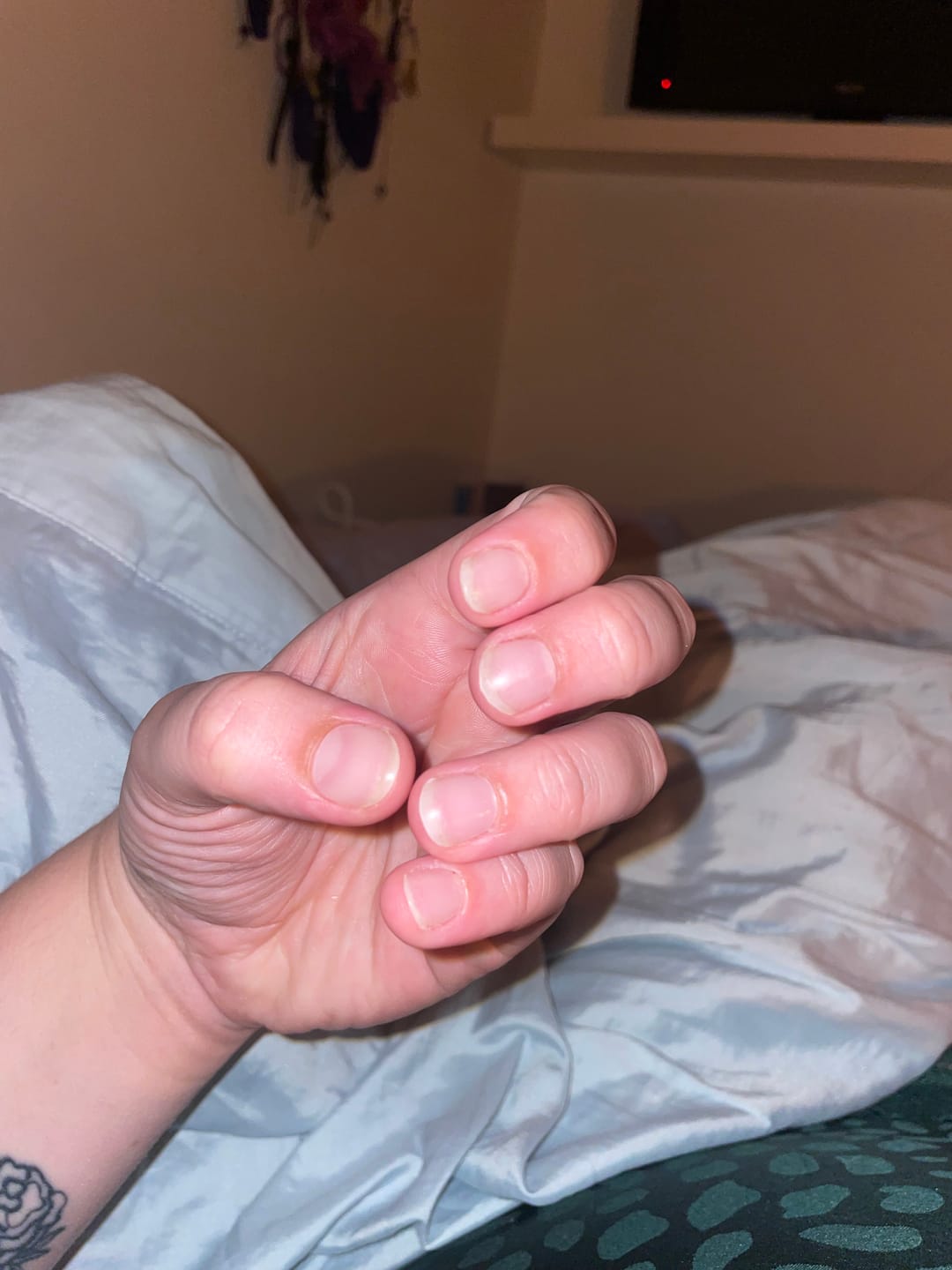 Customer photo review of Crystal Clear DIY Semicured Gel Nail Sticker Kit (STOP NAIL BITING & GROW BRITTLE NAILS)