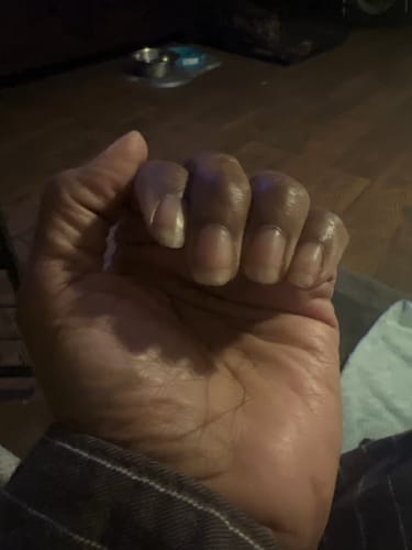 Customer photo review of Rocket Nail Fuel Nail Repair - Clear