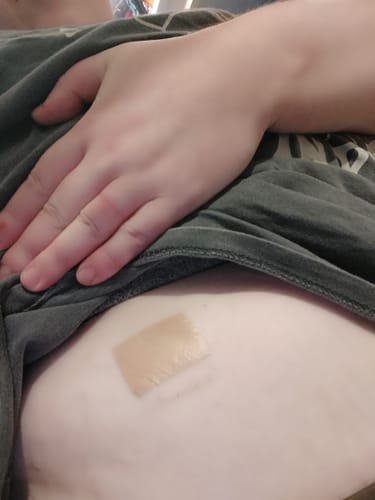 Customer photo review of Vitamin Patches - 5 day sample supply