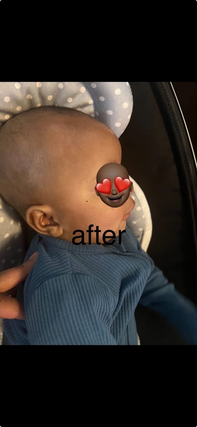 Customer photo review of X-zema & Rash Soothing Cream