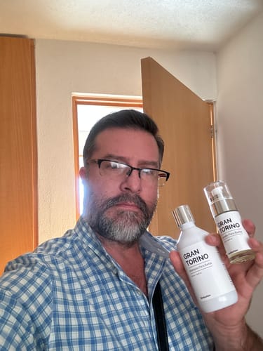 Customer photo review of Aceite y Shampoo Para Barba - Paquete 2 Piezas