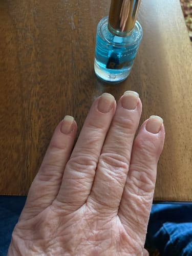 Customer photo review of Rocket Nail Fuel Nail Repair - Clear