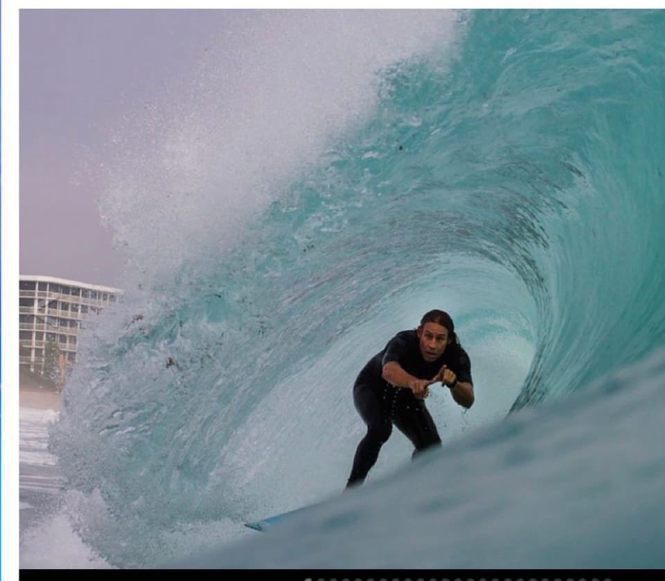 Customer photo review of FCS X Sharkbanz POD - Surf Shark Deterrent