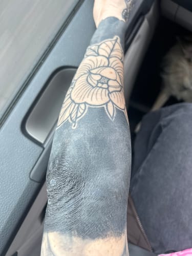 Customer photo review of TattooNumbx Numbing Cream
