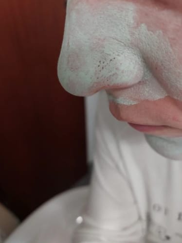 Customer photo review of Green Tea Mask