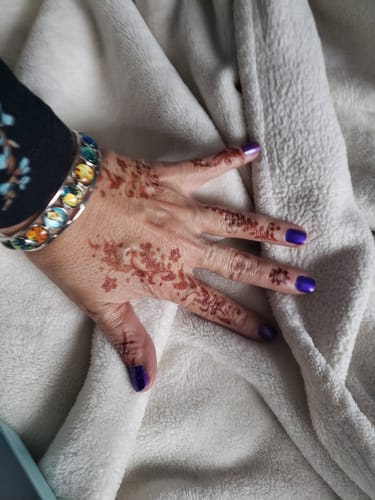 Customer photo review of "Van Gogh's Greatest Hits" Bracelet