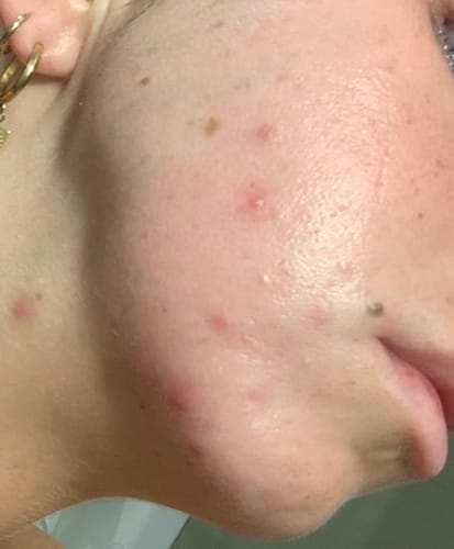 Customer photo review of Advanced Reset Program™