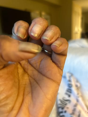 Customer photo review of Conceal & Repair Kit