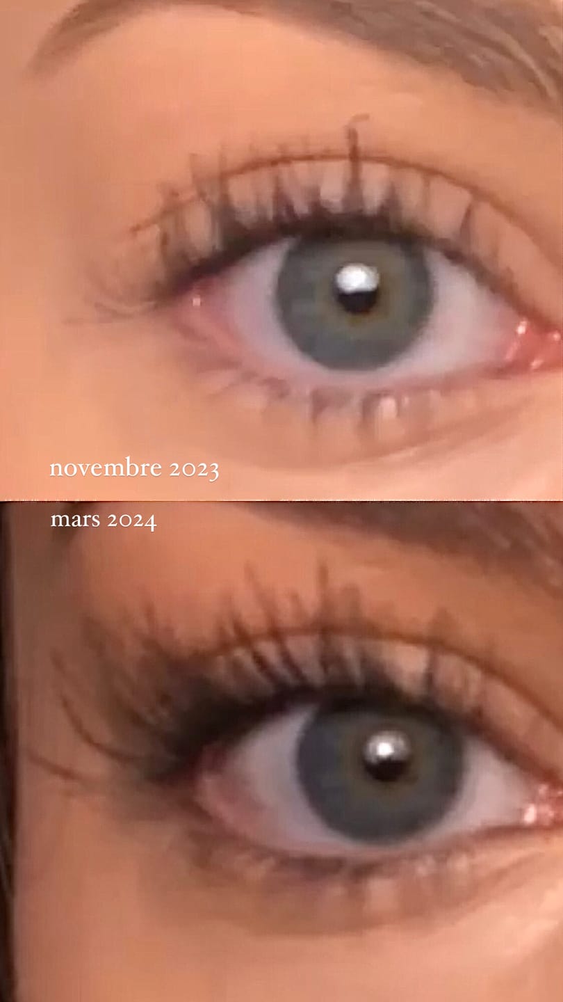 Customer photo review of LASH GROWTH SERUM
