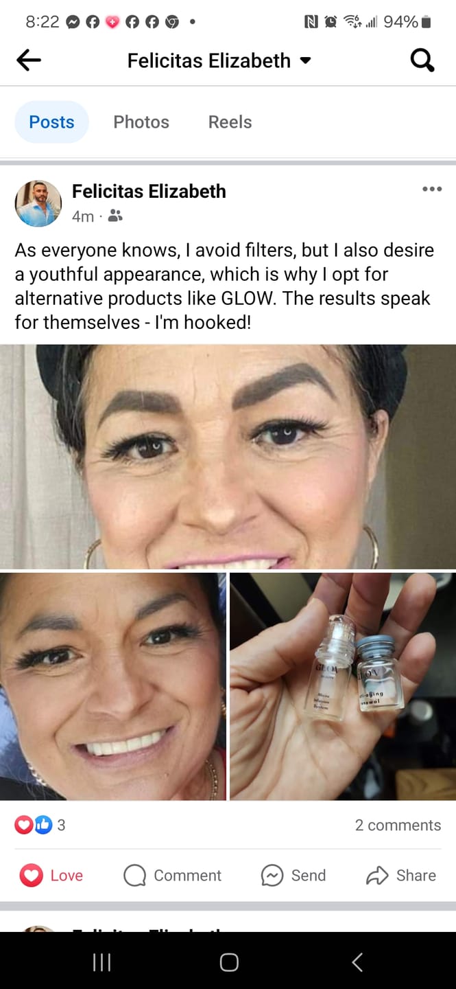 Customer photo review of Glov Serum-Infused Microneedle Eye Patches