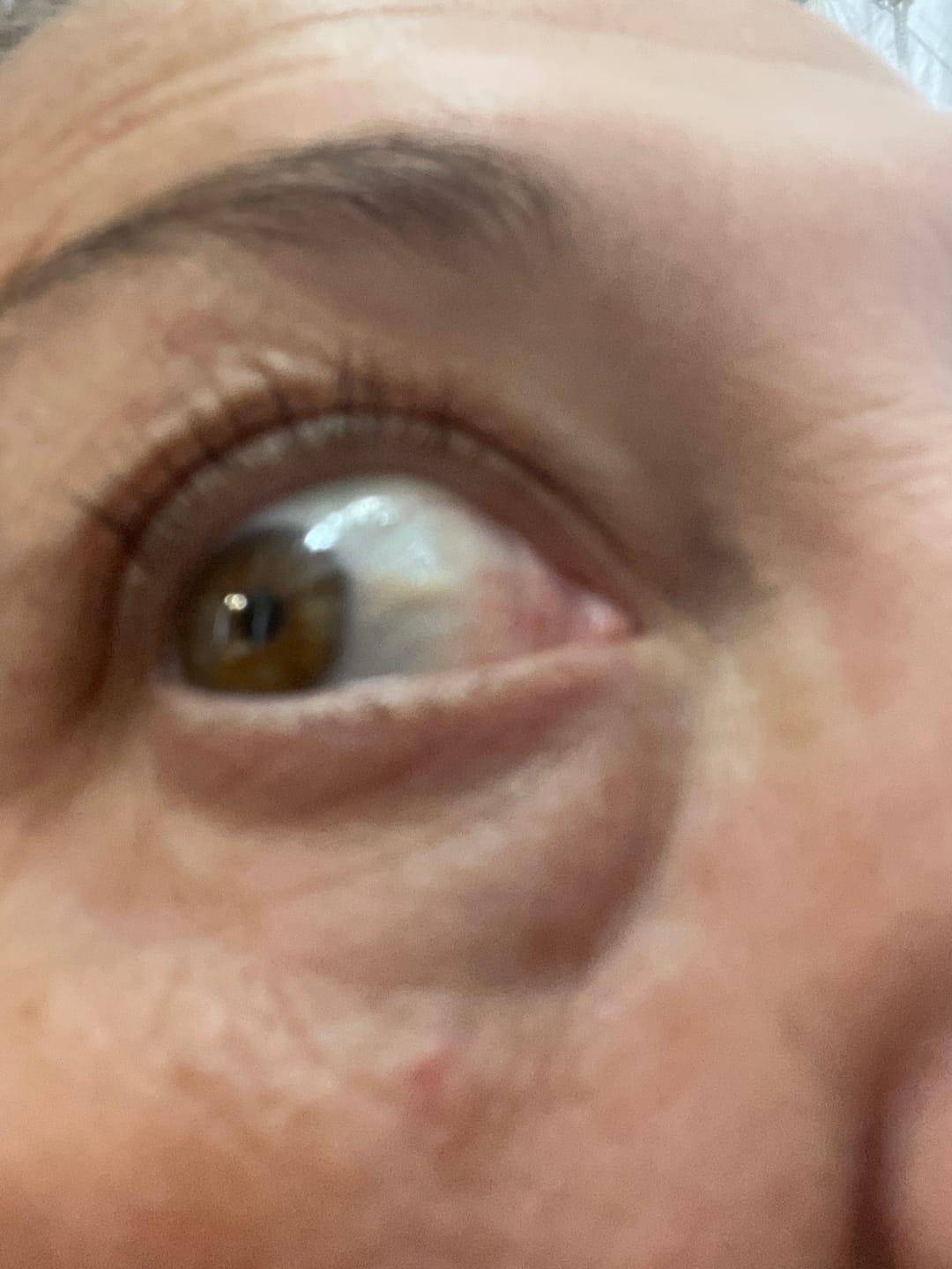 Customer photo review of LASHCOCA!NE PEPActive - Wimpernserum ohne Hormone