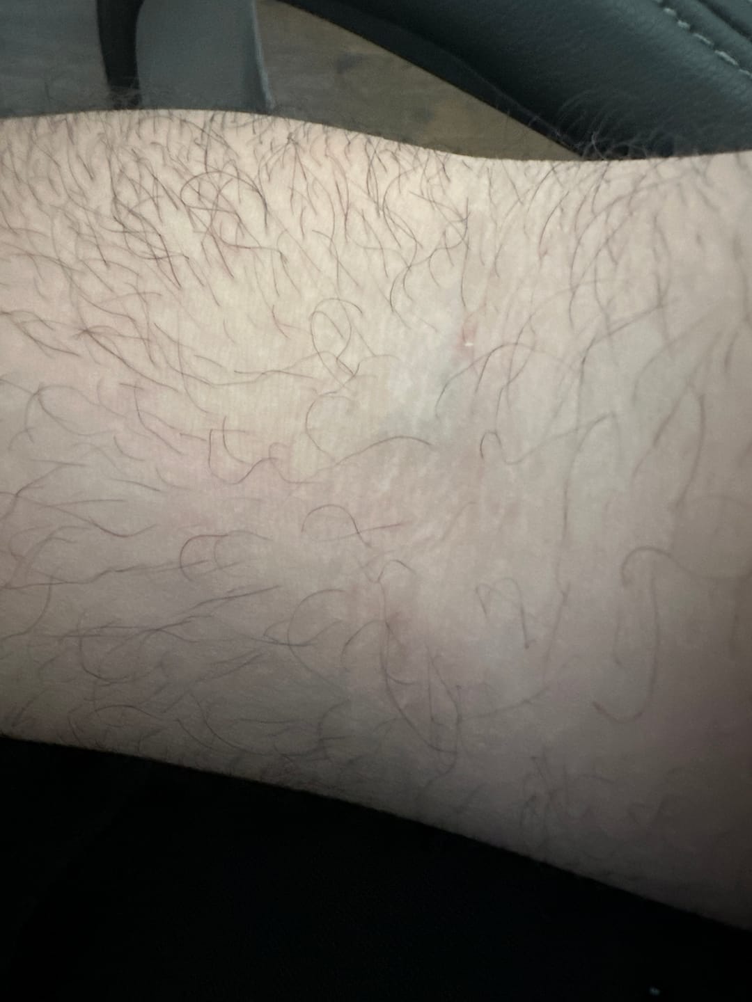 Customer photo review of Psoriasis Honey Nourishing Scalp and Skin Serum