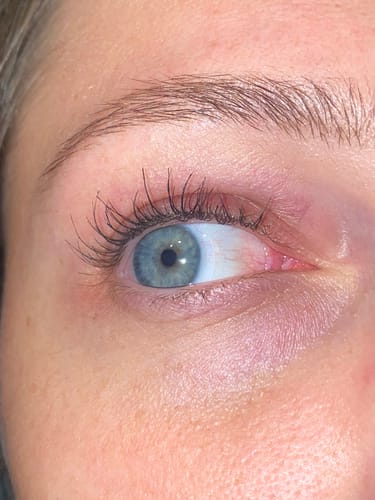 Customer photo review of 2x iGlow Lash Maximizer – Lash Serum, 3 ml