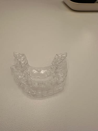 Customer photo review of REORDER-Upper and Lower Retainers Set