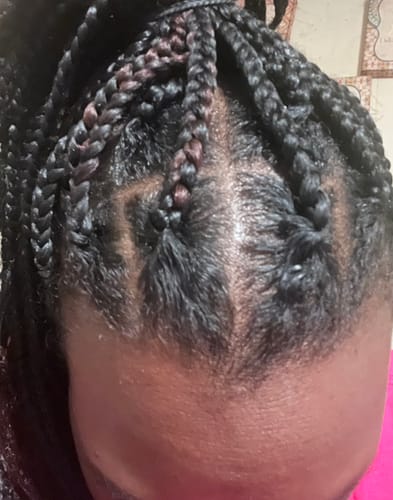 Customer photo review of The Ultimate Hair Growth Guide eBook