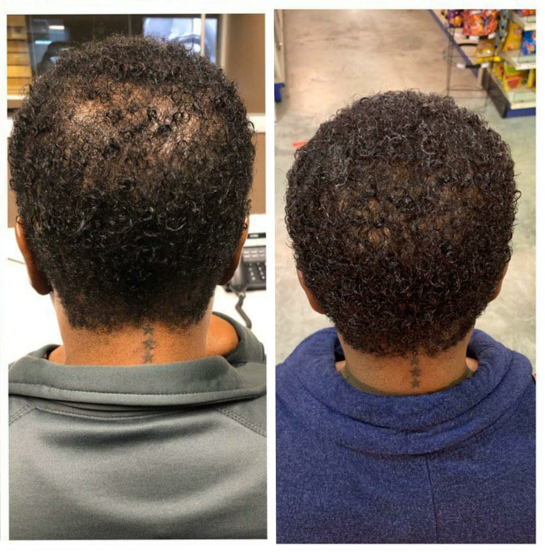 Customer photo review of Hair Follicle Mist