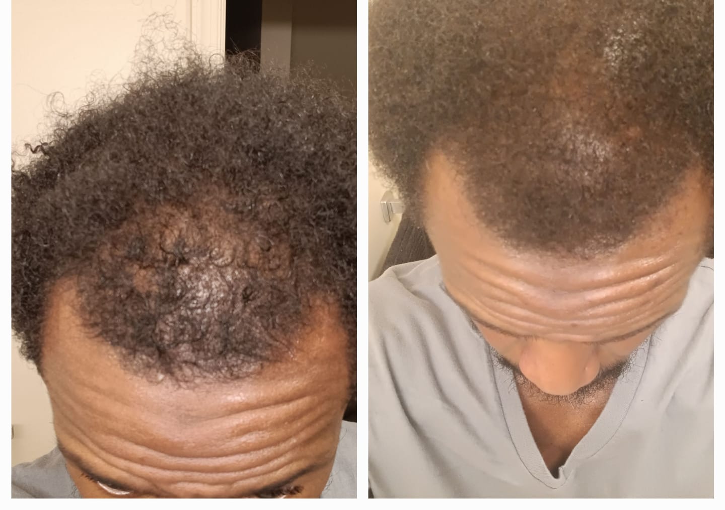 Customer photo review of LARGE RARE BATANA