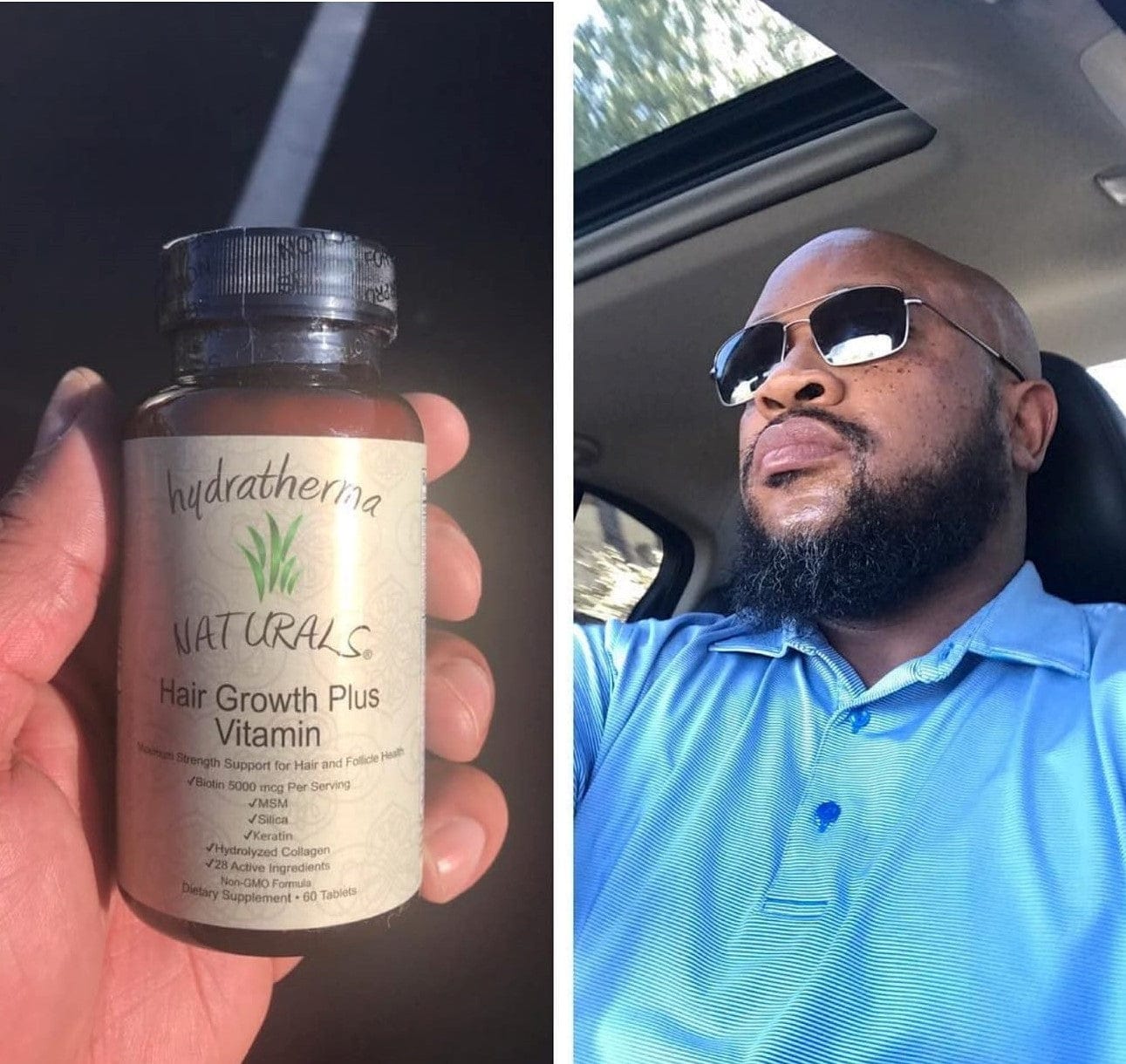 Customer photo review of Hair Growth Plus Vitamins